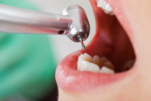 Best Emergency Treatment for Oral Infections in Zephyrhills, FL